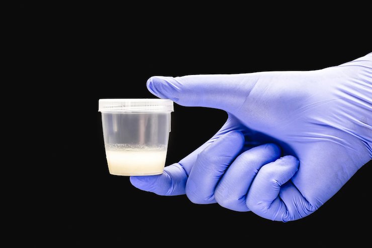 Ghana’s New Goldmine: The Unexpected Rise of Sperm Selling